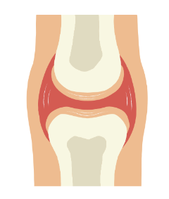 Douleurs musculaires et articulaires