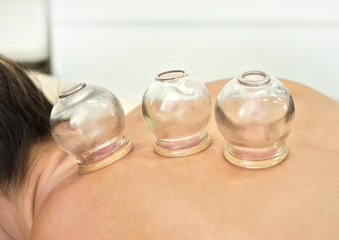 Ventouses posées sur le dos